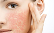 Сыворотки для чувствительной кожи лица