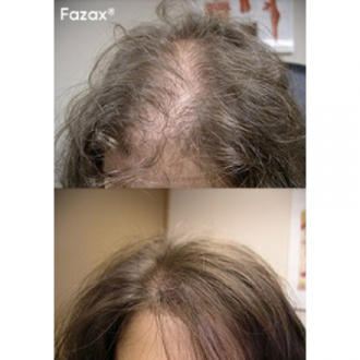 Fazax, Средство для стимуляции роста волос Depixil 15%, 8 мл
